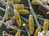 SEM of diatoms and blue-green algae