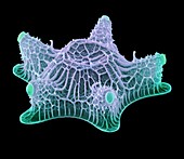 Diatom alga,SEM