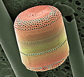 Diatom,SEM