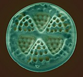 Diatom,SEM