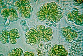 Photomicrograph of Botryococcus sp