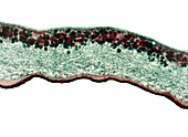 Lichen,light micrograph
