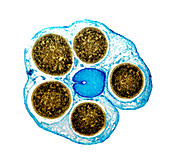 Liverwort spore cases,light micrograph