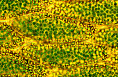 Moss leaf cells,light micrograph
