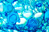 Cucumber stem tissue,light micrograph