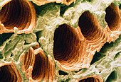 SEM of vascular tissue of tobacco leaf