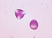 Pollen grains,light micrograph