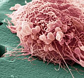 Migrating breast cancer cell,SEM