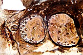 Caterpillar skin,light micrograph