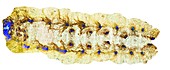 Whole caterpillar skin,light micrograph