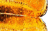 Brain tissue,light micrograph