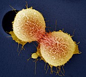 Cervical cancer cell division,SEM