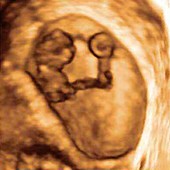 Foetus at 9 weeks,3D ultrasound