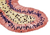 Gall bladder surface,light micrograph