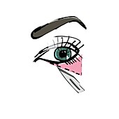 Cosmetic eye surgery,conceptual artwork