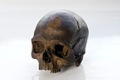Neolithic human skull