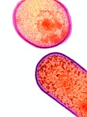 Clostridium difficile bacteria,TEM