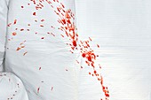 Surgeon's gown spattered with blood