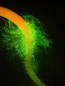 Listeria bacteria on broccoli root hairs