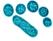 E coli bacteria,TEM