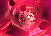Red blood cells in blood vessel,artwork