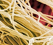 Synovial collagen fibres,SEM