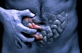 Crohn's disease,artwork