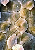 Skin surface,SEM