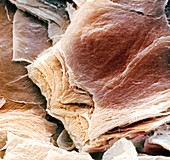 Skin surface,SEM