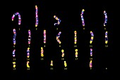 Human sperm cell karyotype