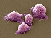 Cervical cancer cells,SEM