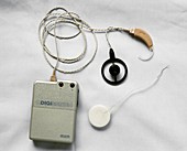 Cochlear implant and amplifier