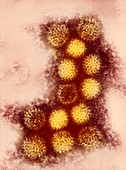 Changuinola virus,TEM