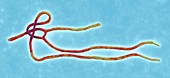 Ebola virus particles,TEM