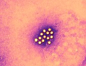 Hepatitis A virus particles,TEM