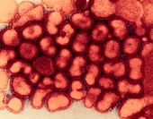 Influenza A virus particles,TEM