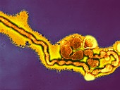 Influenza C virus,TEM