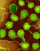 La Crosse encephalitis virus,TEM