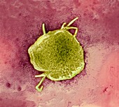 Measles virus particles,TEM