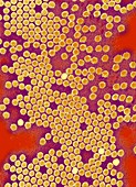 Poliovirus particles,TEM