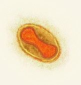 Smallpox virus particle,TEM