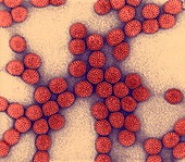 Rotavirus particles,TEM