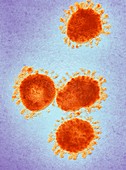 Infectious bronchitis virus (IBV),TEM
