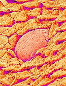 Tongue surface,SEM