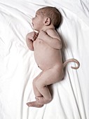 Human baby with a tail