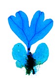 Fern plant reproduction,light micrograph