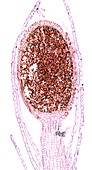 Liverwort spore capsule,light micrograph