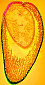 Moss spore capsule,light micrograph
