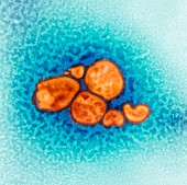 2009 H1N1 swine flu virus,TEM