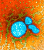 2009 H1N1 swine flu virus,TEM